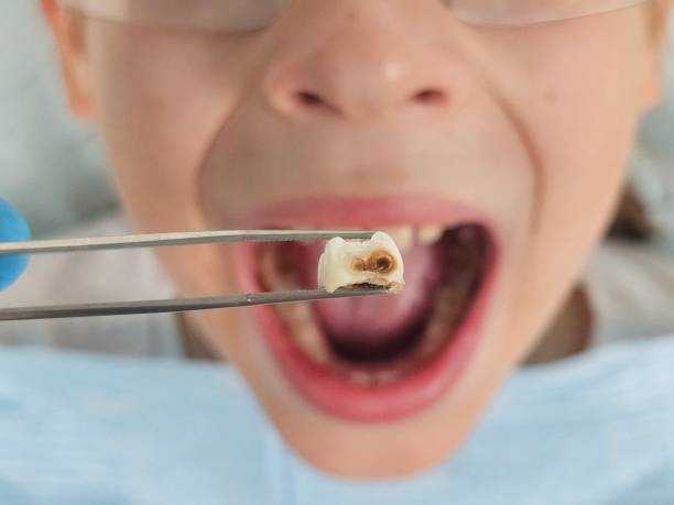 Best Emergency Treatment for Oral Infections in Lmar, DE